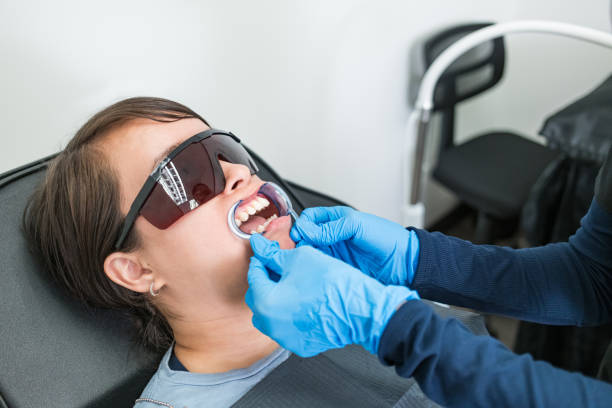 Best Emergency Wisdom Tooth Extraction in Tamalpais Homestead Valley, CA